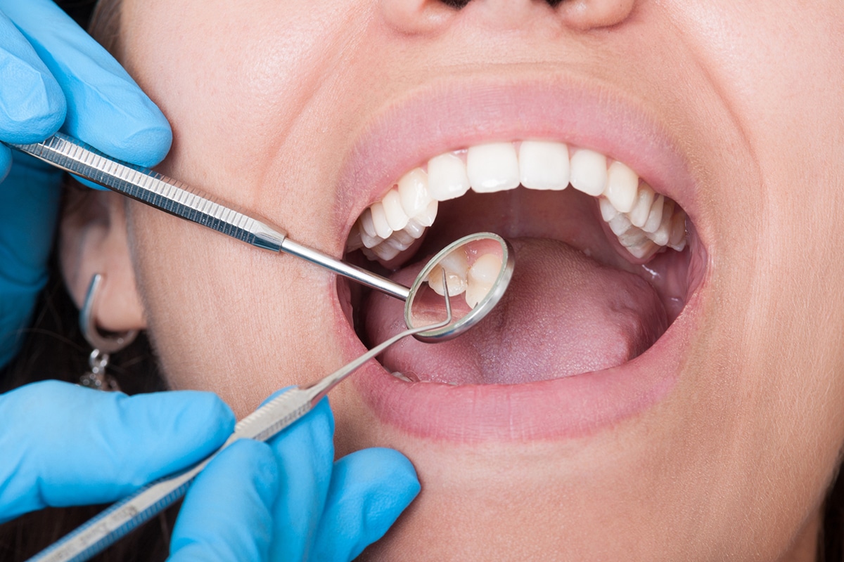 how-often-should-you-go-to-the-dentist-glassman-dental